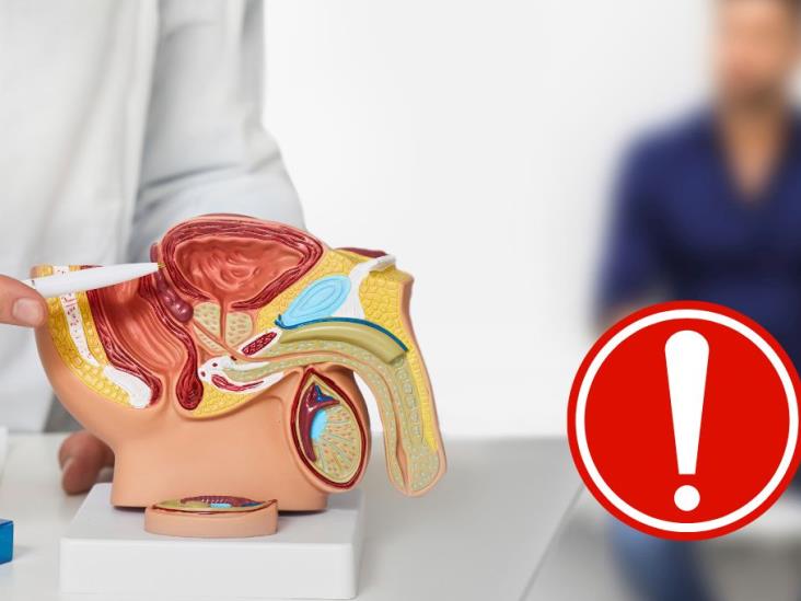 Día Mundial del cáncer de Próstata: ¿cuáles son los factores de riesgo?