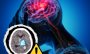 Cuidado, estos son los síntomas de sufrir un infarto cerebral