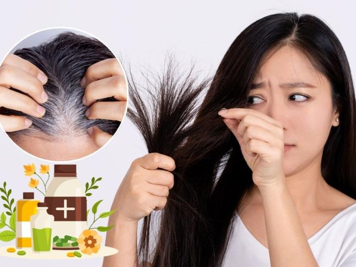 ¿Tienes canas? este es el remedio natural para eliminarlas