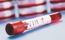 Estados Unidos aprueba nuevo tratamiento preventivo contra el VIH; es un día histórico